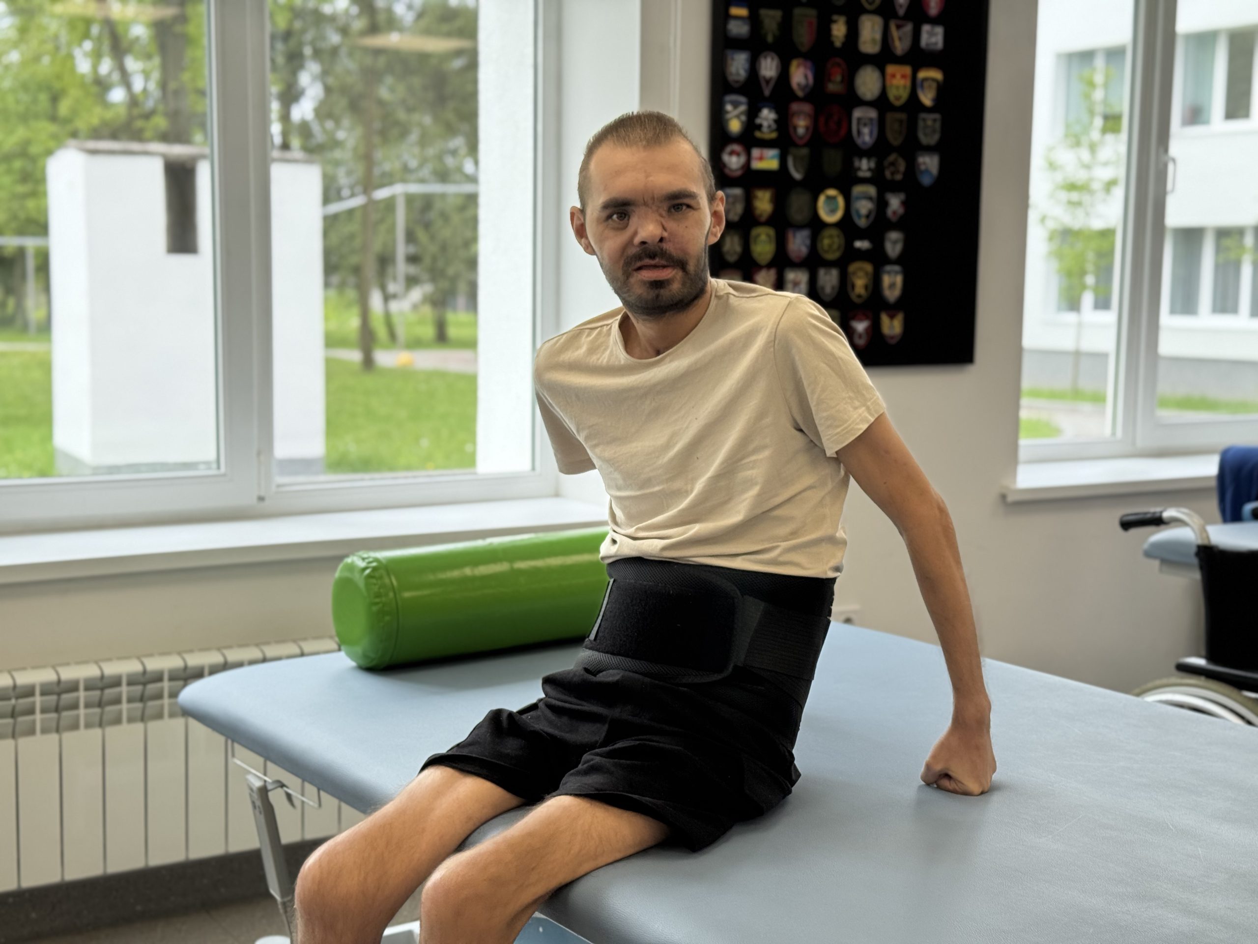Два місяці у комі! Ворожий снаряд розірвався прямо біля обличчя захисника і той отримав важкий забій головного мозку.