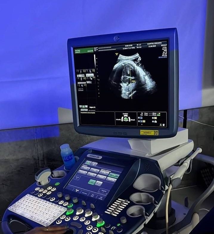 Тренінг з оволодіння практичними навичками “УЗД плоду у першому триместрі вагітності”