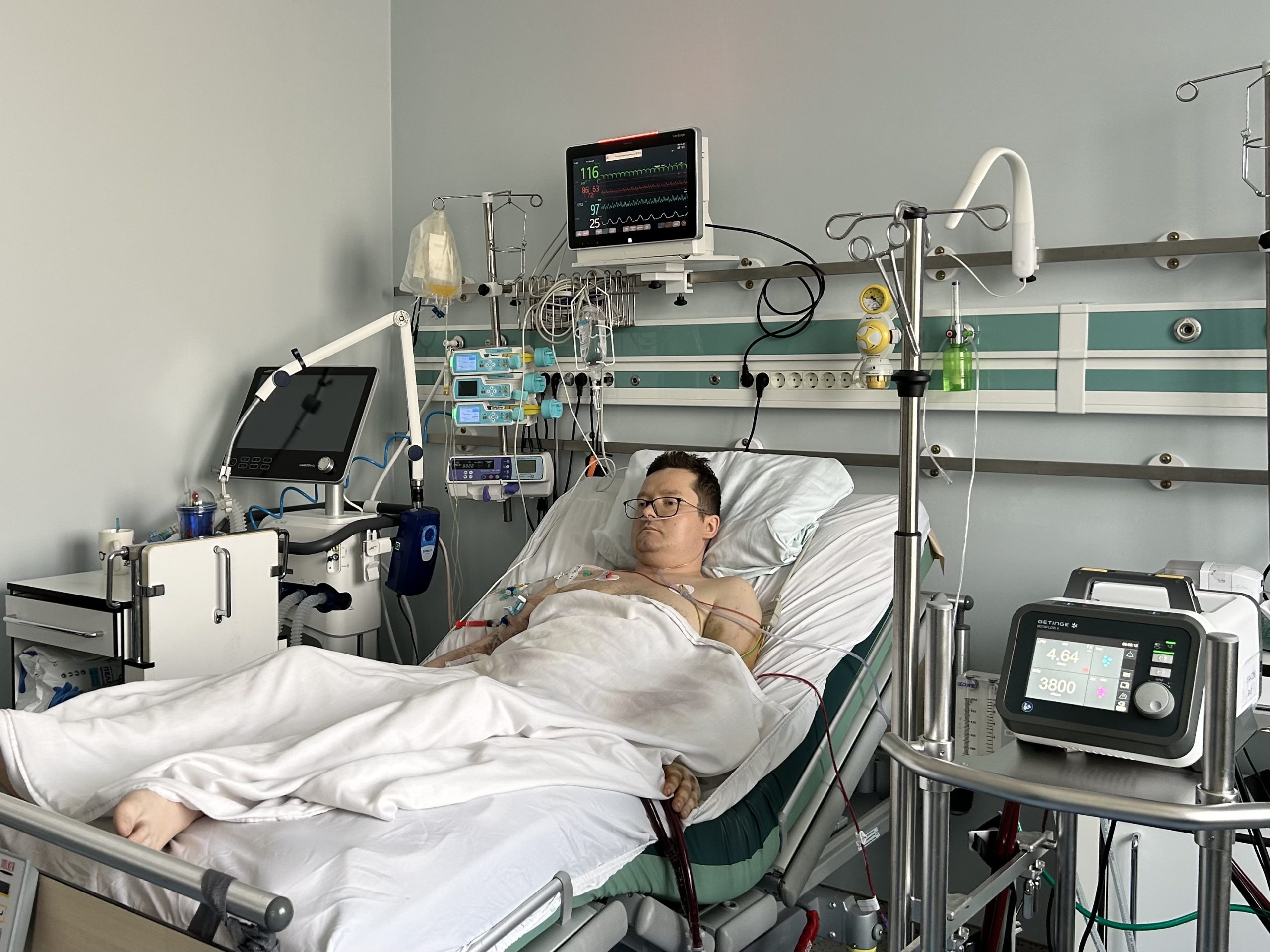 Чоловік в очікуванні донорського серця перебуває у Львові у відділенні інтенсивної терапії